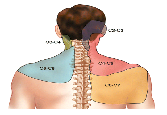 Upper shoulder neck online pain